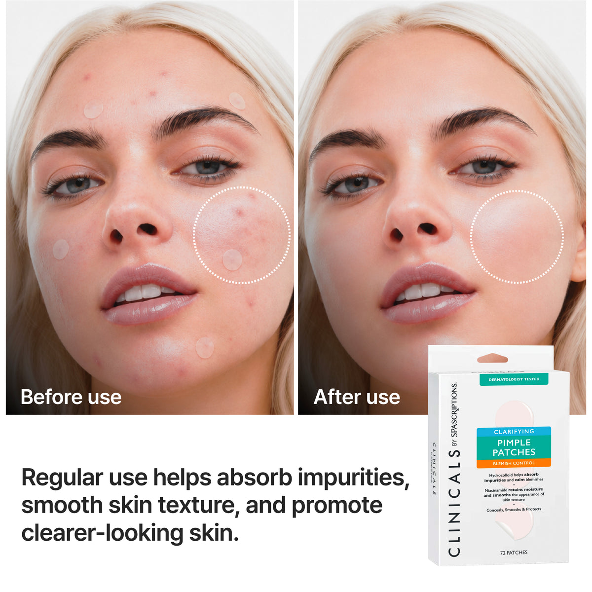 CLINICALS Clarifying Pimple Patches