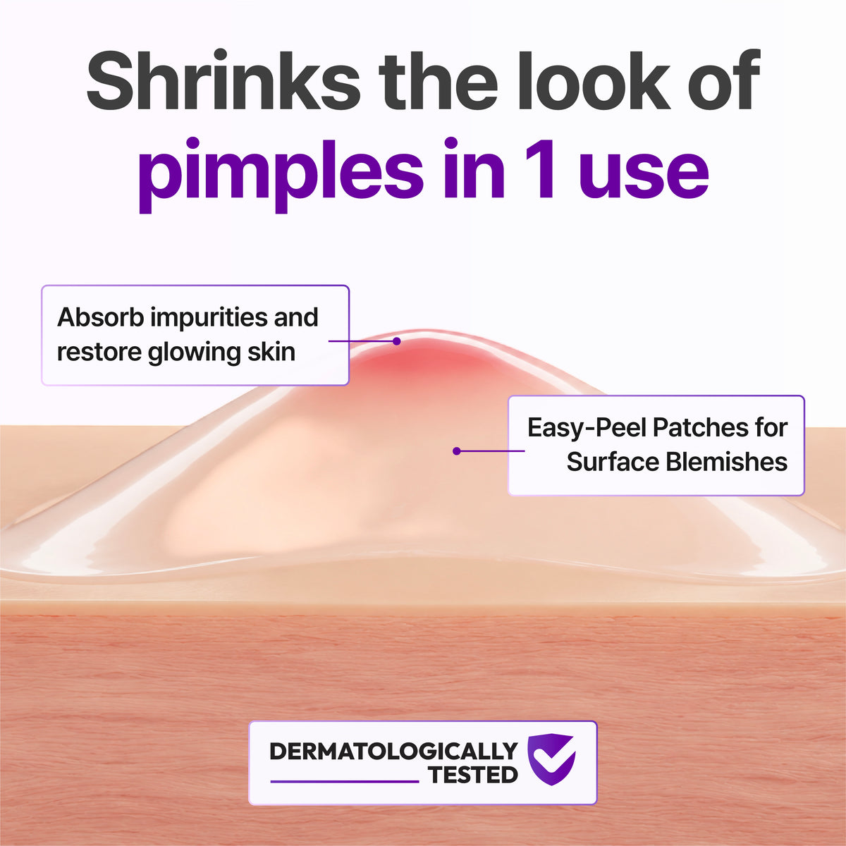 CLINICALS Soothing Pimple Patches 72ct